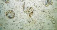 13095-1-AP - TYRP2 / DCT