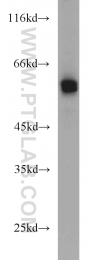 13095-1-AP - TYRP2 / DCT