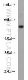 13095-1-AP - TYRP2 / DCT