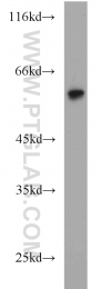 13095-1-AP - TYRP2 / DCT