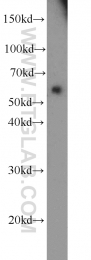13095-1-AP - TYRP2 / DCT