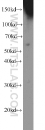 13095-1-AP - TYRP2 / DCT