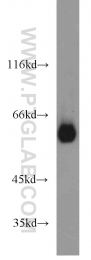 13095-1-AP - TYRP2 / DCT