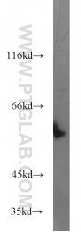 13095-1-AP - TYRP2 / DCT