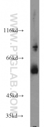 13095-1-AP - TYRP2 / DCT