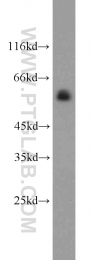 13095-1-AP - TYRP2 / DCT