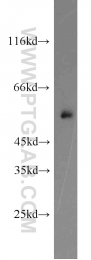 13095-1-AP - TYRP2 / DCT