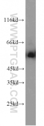 13095-1-AP - TYRP2 / DCT
