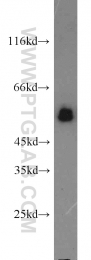 13095-1-AP - TYRP2 / DCT