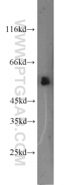 13095-1-AP - TYRP2 / DCT