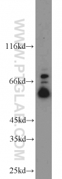 13095-1-AP - TYRP2 / DCT