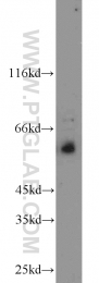 13095-1-AP - TYRP2 / DCT