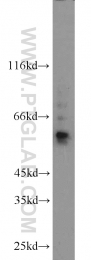 13095-1-AP - TYRP2 / DCT