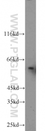 13095-1-AP - TYRP2 / DCT