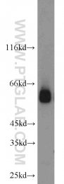 13095-1-AP - TYRP2 / DCT