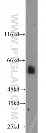 13095-1-AP - TYRP2 / DCT
