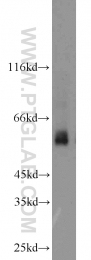 13095-1-AP - TYRP2 / DCT