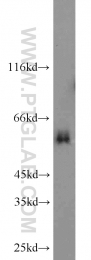 13095-1-AP - TYRP2 / DCT