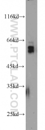 13095-1-AP - TYRP2 / DCT