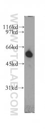 13095-1-AP - TYRP2 / DCT