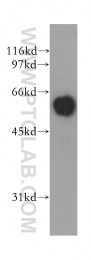 13095-1-AP - TYRP2 / DCT