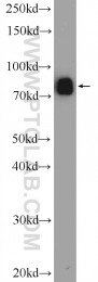 25203-1-AP - DDHD2