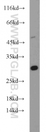 10656-1-AP - DENR / DRP1