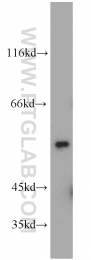 21312-1-AP - DEPDC6 / DEPTOR