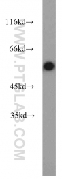 16520-1-AP - Desmin