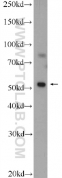 22205-1-AP - Desmin