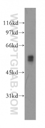 13075-1-AP - DFNA5