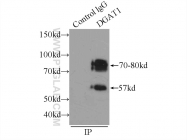 11561-1-AP - DGAT1