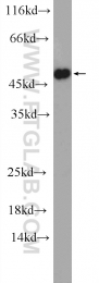 11561-1-AP - DGAT1