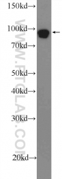 25835-1-AP - DGCR8