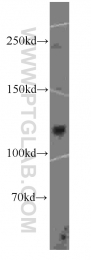 60084-1-Ig - DGCR8