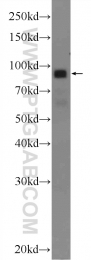 24320-1-AP - DAG kinase beta