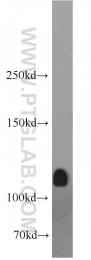 17885-1-AP - DAG kinase theta