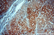 16314-1-AP - Deoxyguanosine kinase
