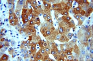 16314-1-AP - Deoxyguanosine kinase