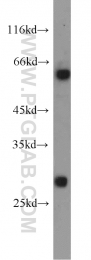 16314-1-AP - Deoxyguanosine kinase