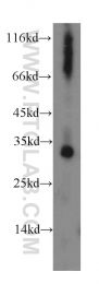 16314-1-AP - Deoxyguanosine kinase