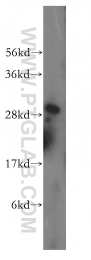 15279-1-AP - DHRS4