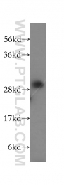 15279-1-AP - DHRS4
