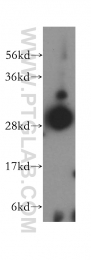 15279-1-AP - DHRS4