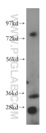 15563-1-AP - DIMT1L