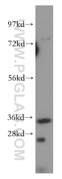 15563-1-AP - DIMT1L
