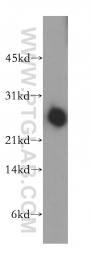 12634-1-AP - DIRAS1