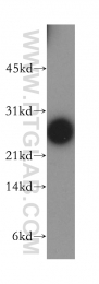 12634-1-AP - DIRAS1