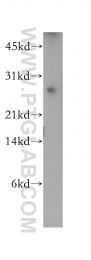 12634-1-AP - DIRAS1