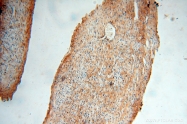 13816-1-AP - Dixin